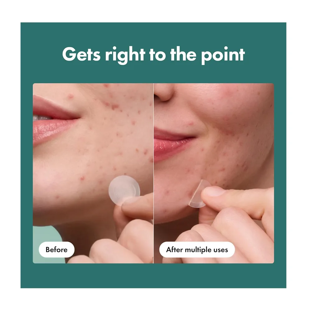 Premium everyday wear hero cosmetics micropoint pimple patch, salicylic acid, cica, for acne-prone skin, 8-pack