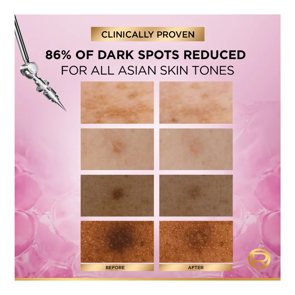 Close-up design of l'oreal paris glycolic-bright 8% melasyl anti-dark spot brightening serum, glycolic + niacinamide, for sensitive skin, 30ml